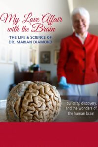 My Love Affair with the Brain Online En Netflix