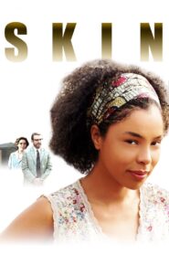 Skin Online En Netflix